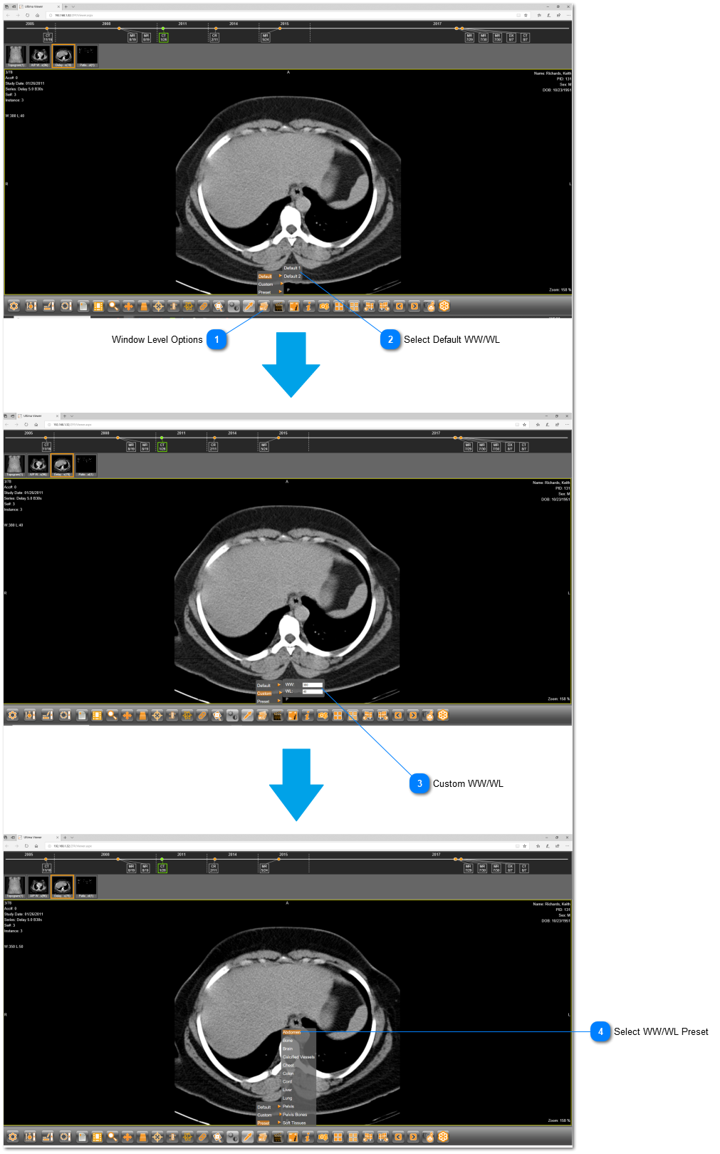 17.2.5.2. Window Level Options