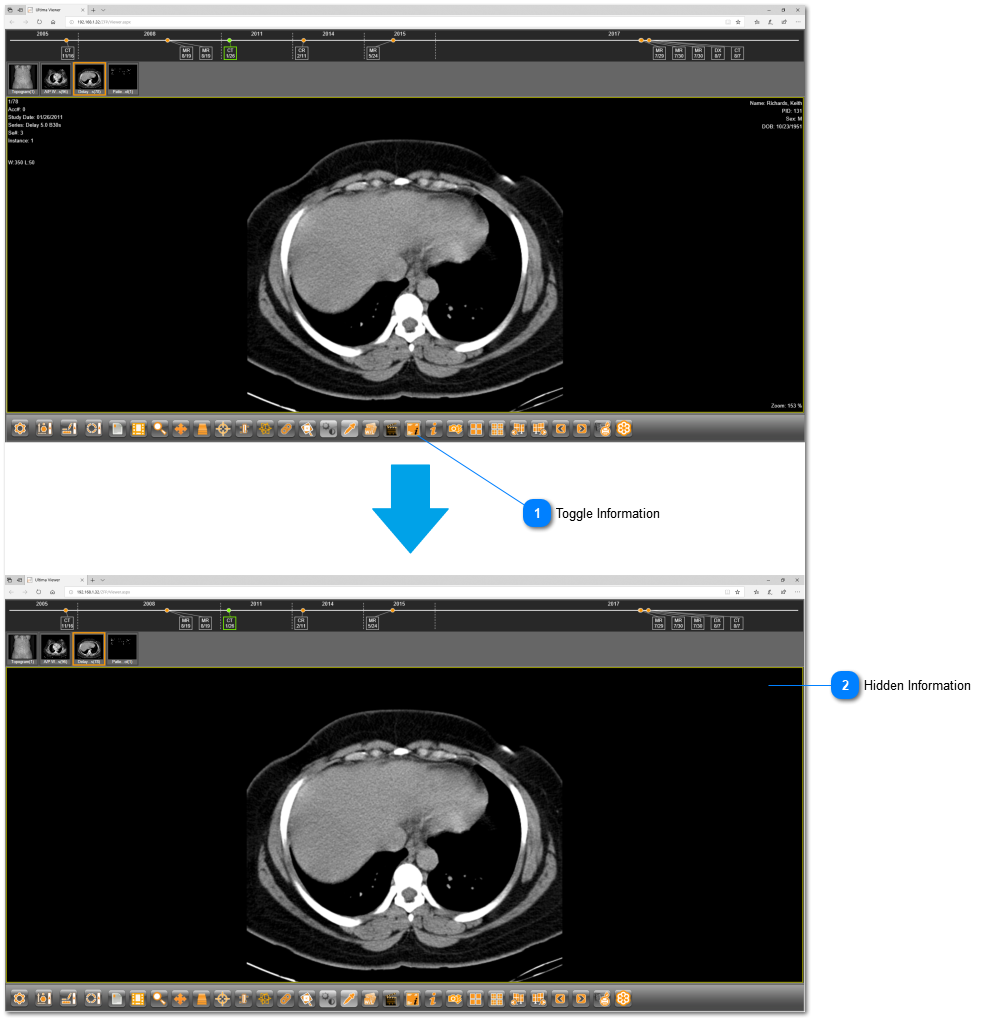 17.2.5.9. Toggle Information